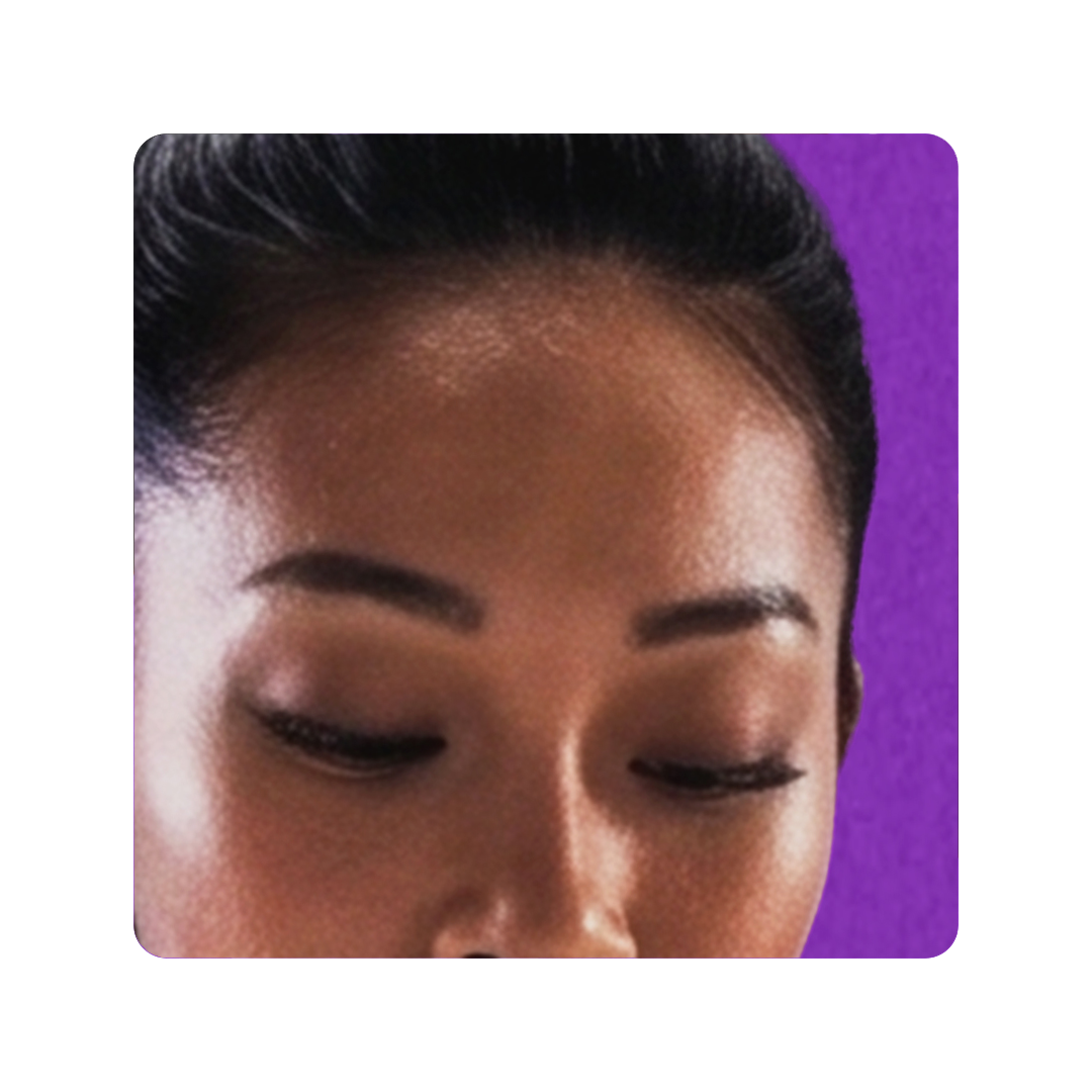 AFT Forehead